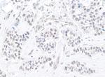 TIF1 Alpha/TRIM24 Polyclonal Antibody
