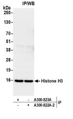 Histone H3 Antibody in Immunoprecipitation (IP)