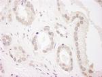 USP34 Polyclonal Antibody