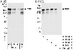 TPR Polyclonal Antibody