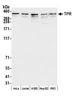 TPR Polyclonal Antibody