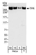 TPR Polyclonal Antibody