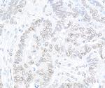 TPR Polyclonal Antibody