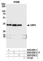 USP4 Antibody in Immunoprecipitation (IP)