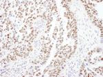 PPP4R2 Polyclonal Antibody