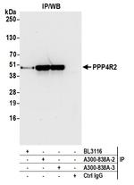 PPP4R2 Antibody in Immunoprecipitation (IP)
