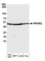 PPP4R2 Antibody in Western Blot (WB)