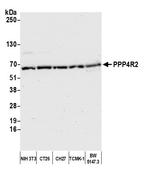 PPP4R2 Antibody in Western Blot (WB)