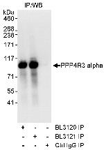 PPP4R3 Alpha Antibody in Immunoprecipitation (IP)