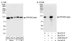 PPP4R3 Beta Antibody in Western Blot (WB)