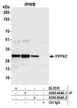PPP6C Antibody in Immunoprecipitation (IP)