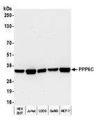 PPP6C Polyclonal Antibody