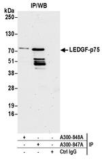 LEDGF/p75 Antibody in Immunoprecipitation (IP)