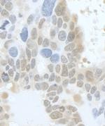 HURP/DLG7 Antibody in Immunohistochemistry (Paraffin) (IHC (P))
