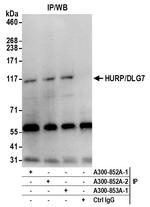 HURP/DLG7 Antibody in Immunoprecipitation (IP)