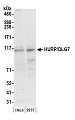 HURP/DLG7 Antibody in Western Blot (WB)