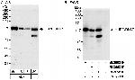 HURP/DLG7 Antibody in Western Blot (WB)
