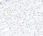DHX9 Antibody in Immunohistochemistry (Paraffin) (IHC (P))