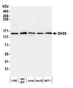 DHX9 Antibody in Western Blot (WB)