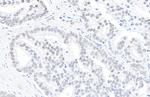DHX9 Polyclonal Antibody