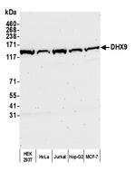 DHX9 Antibody in Western Blot (WB)