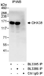 DHX38 Antibody in Immunoprecipitation (IP)