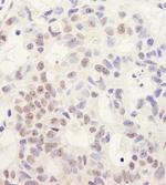 DHX38 Antibody in Immunohistochemistry (Paraffin) (IHC (P))