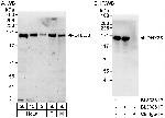 DHX38 Antibody in Western Blot (WB)
