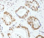 E1B-AP5 Polyclonal Antibody