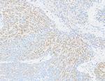 FOX2/RBM9 Polyclonal Antibody