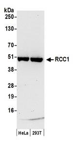 RCC1 Polyclonal Antibody