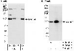 Gemin4 Antibody in Western Blot (WB)