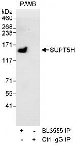 SUPT5H Polyclonal Antibody