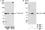 CDK5RAP3 Polyclonal Antibody