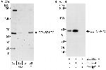 CDK5RAP3 Polyclonal Antibody