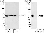 RCC2 Antibody in Western Blot (WB)