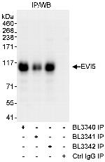 EVI5 Antibody in Immunoprecipitation (IP)
