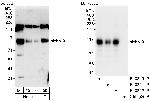 EVI5 Polyclonal Antibody