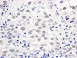 PELP1/MNAR Polyclonal Antibody