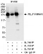 PELP1/MNAR Antibody in Immunoprecipitation (IP)