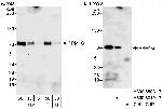 PPM1G Polyclonal Antibody