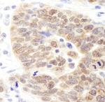 JMJD1B Polyclonal Antibody