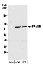 PPM1B Polyclonal Antibody