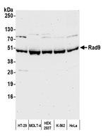 Rad9 Antibody in Western Blot (WB)