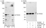P4HA2 Polyclonal Antibody