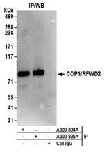 COP1/RFWD2 Antibody in Immunoprecipitation (IP)
