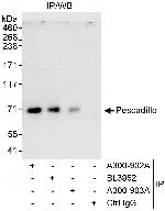 Pescadillo Antibody in Immunoprecipitation (IP)