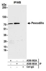 Pescadillo Antibody in Immunoprecipitation (IP)