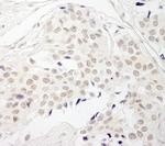 PPP1CB Polyclonal Antibody