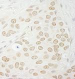 PPP1CC Polyclonal Antibody